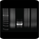 PCR-amplification of normal B cell DNA gives a polyclonal smear. B cells derived from the activation of a single clone show only one band of DNA. 