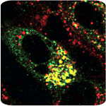 HCV core protein (green) accumulates on the surface of lipid droplets (red). 