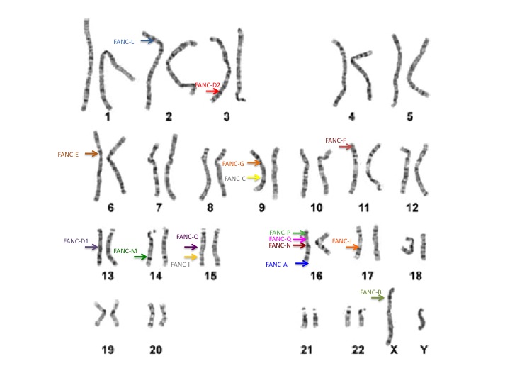 karyotype with FA genes