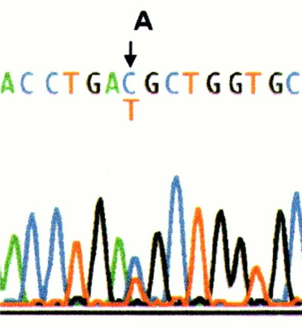 Sequencing